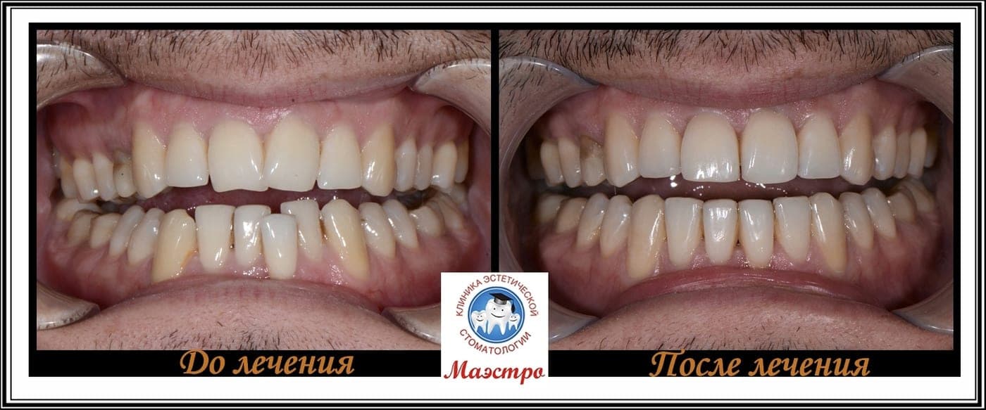 Панорамный снимок и ортодонтическая диагностика
