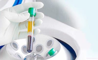 Процедура Plasmolifting в стоматологии