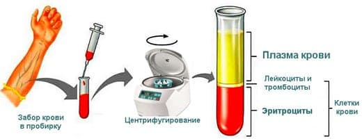 Центрифугирование крови для получения тромбоцитарной аутоплазмы