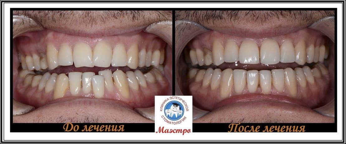 Ортодонтия — пациент 2, фото 3