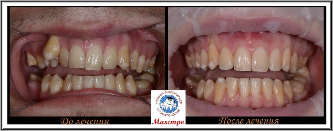 Ортодонтия — пациент 9, фото 1