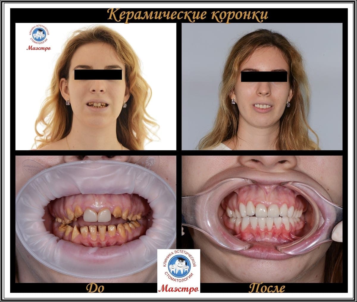 Ортопедия — пациент 1, До и после: портрет и крупный план