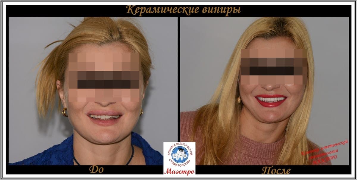 Ортопедия — пациент 10, До и после: портрет