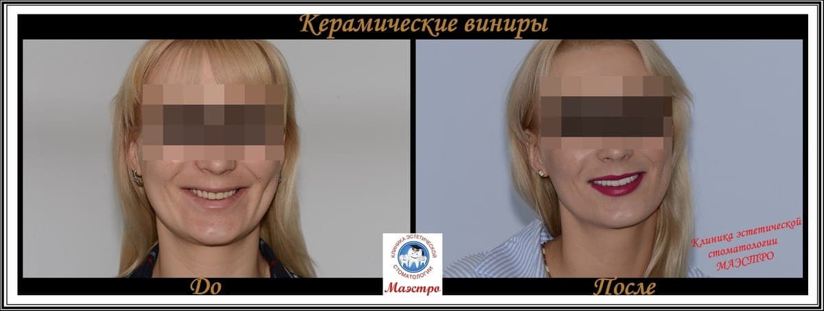 Ортопедия — пациент 11, До и после: портрет