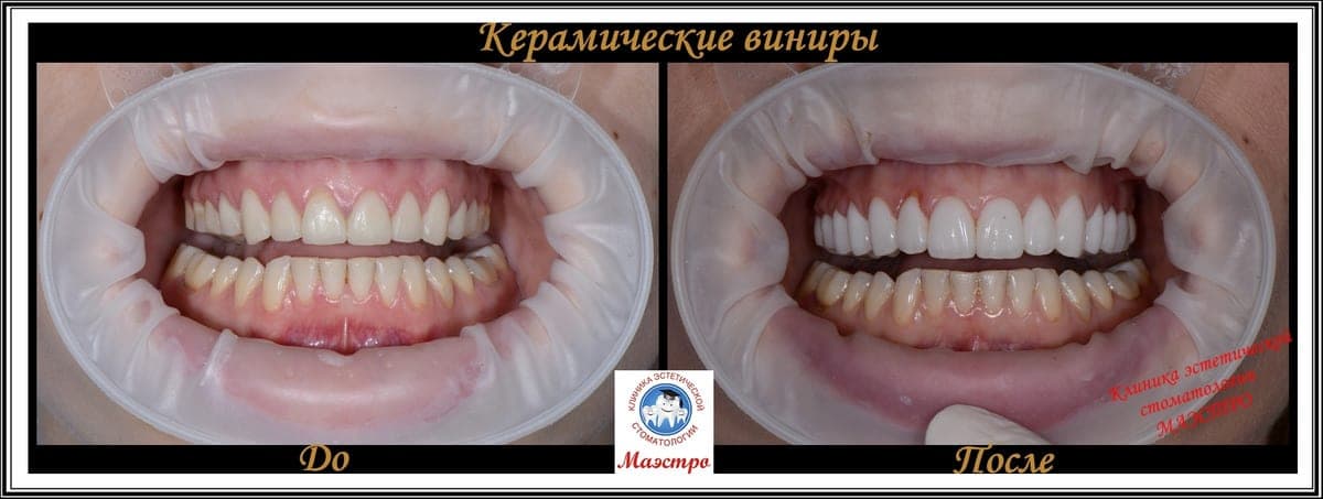 Ортопедия — пациент 11, Крупный план до
