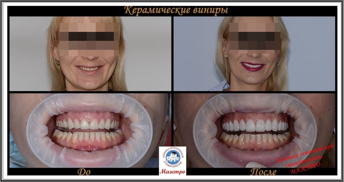 Ортопедия — пациент 11, Крупный план после