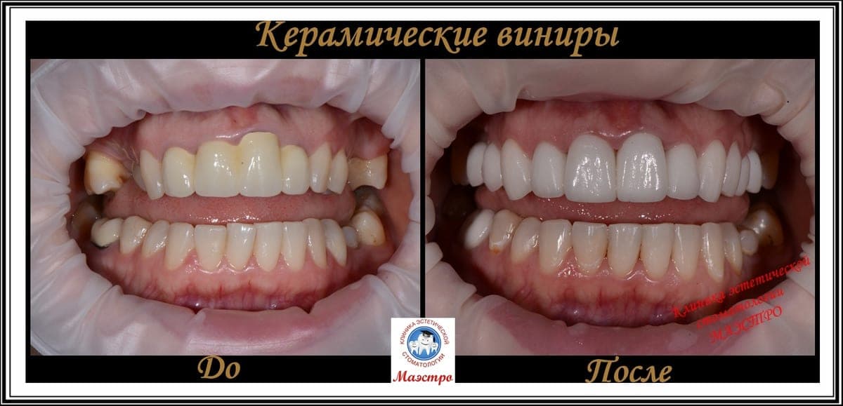 Ортопедия — пациент 13, До и после: крупный план