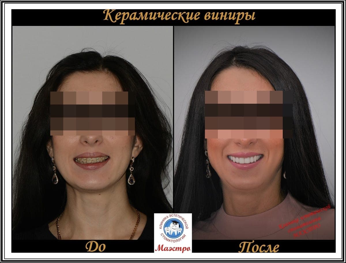 Ортопедия — пациент 13, Портрет до лечения