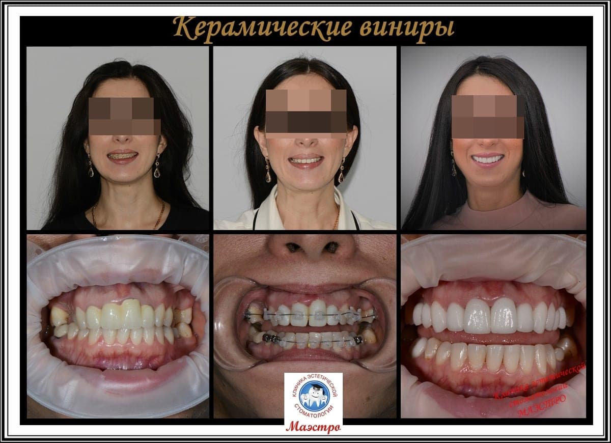 Ортопедия — пациент 13, Портрет после лечения