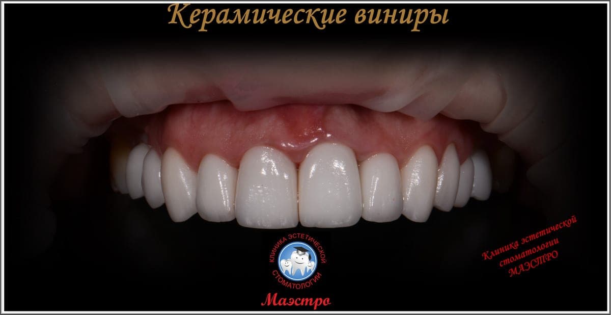 Ортопедия — пациент 13, Детальный результат