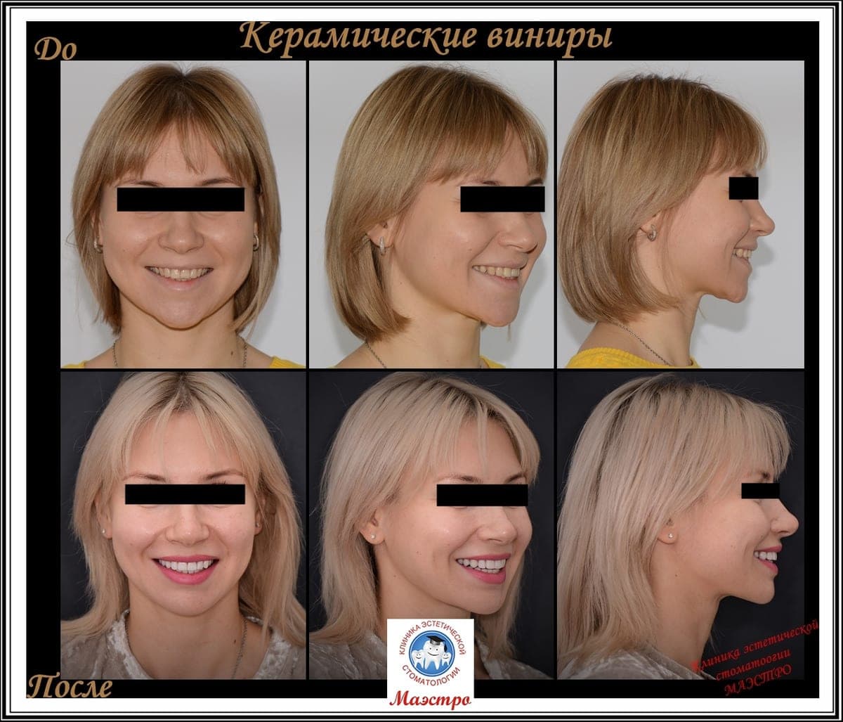 Ортопедия — пациент 14, Шесть ракурсов: до и после
