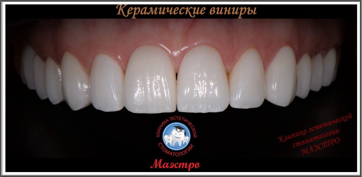 Ортопедия — пациент 14, Крупный план результата