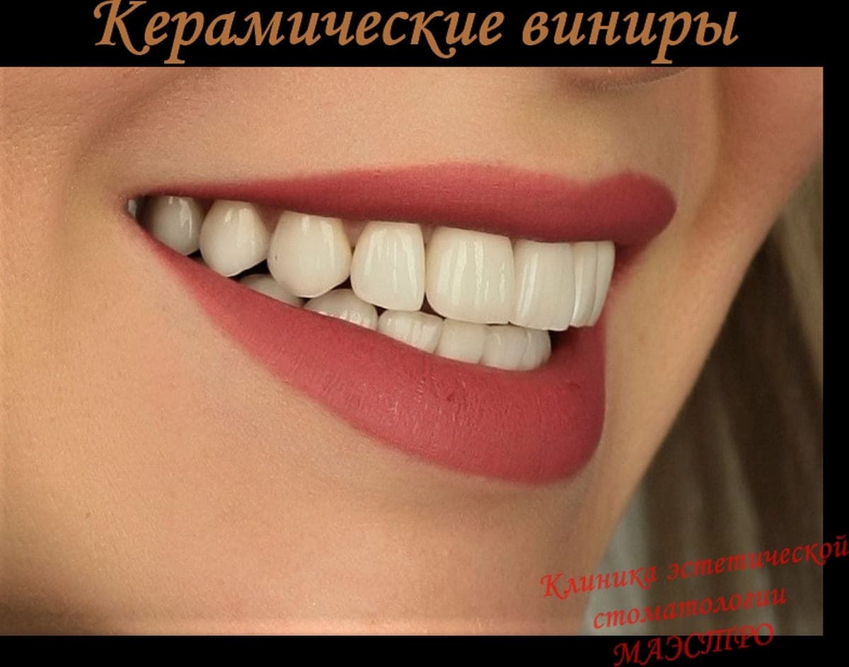 Ортопедия — пациент 14, Детальный вид виниров