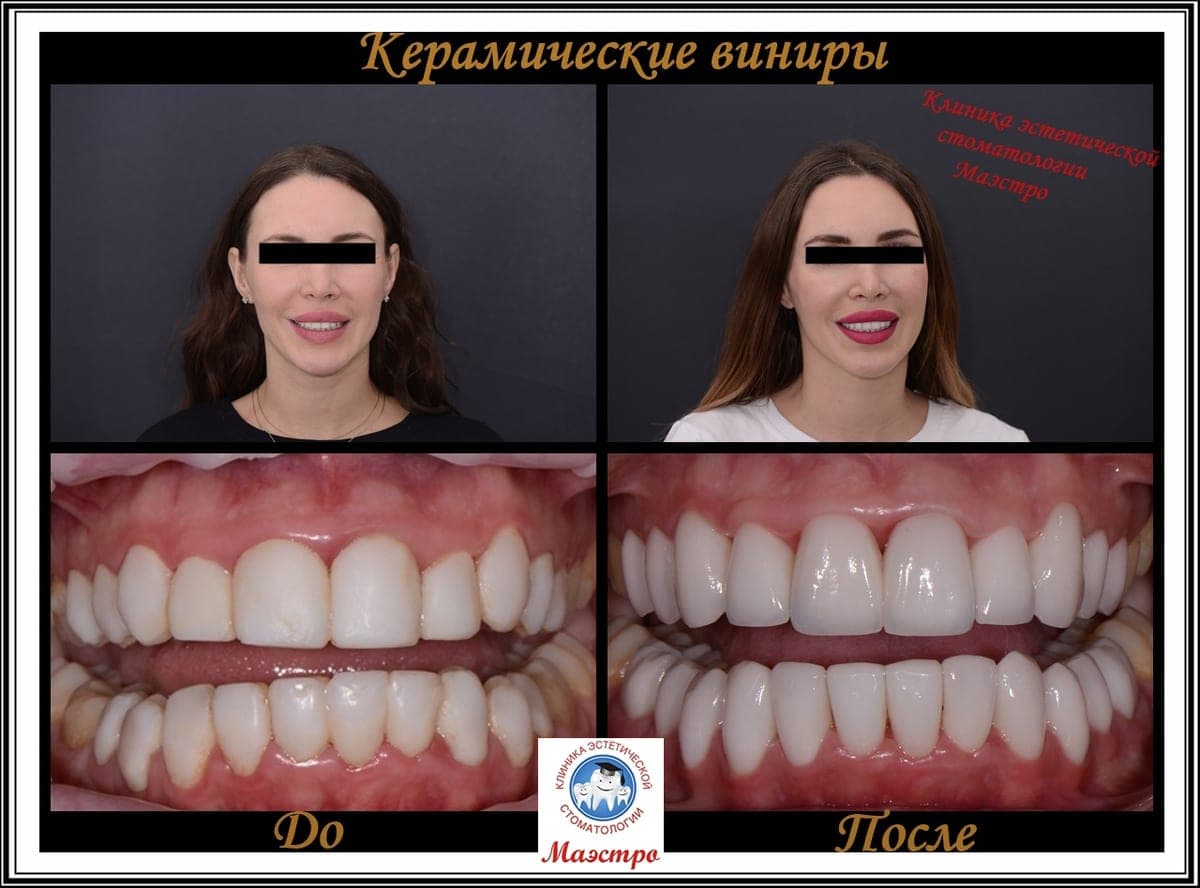 Ортопедия — пациент 15, До и после: портрет и макро