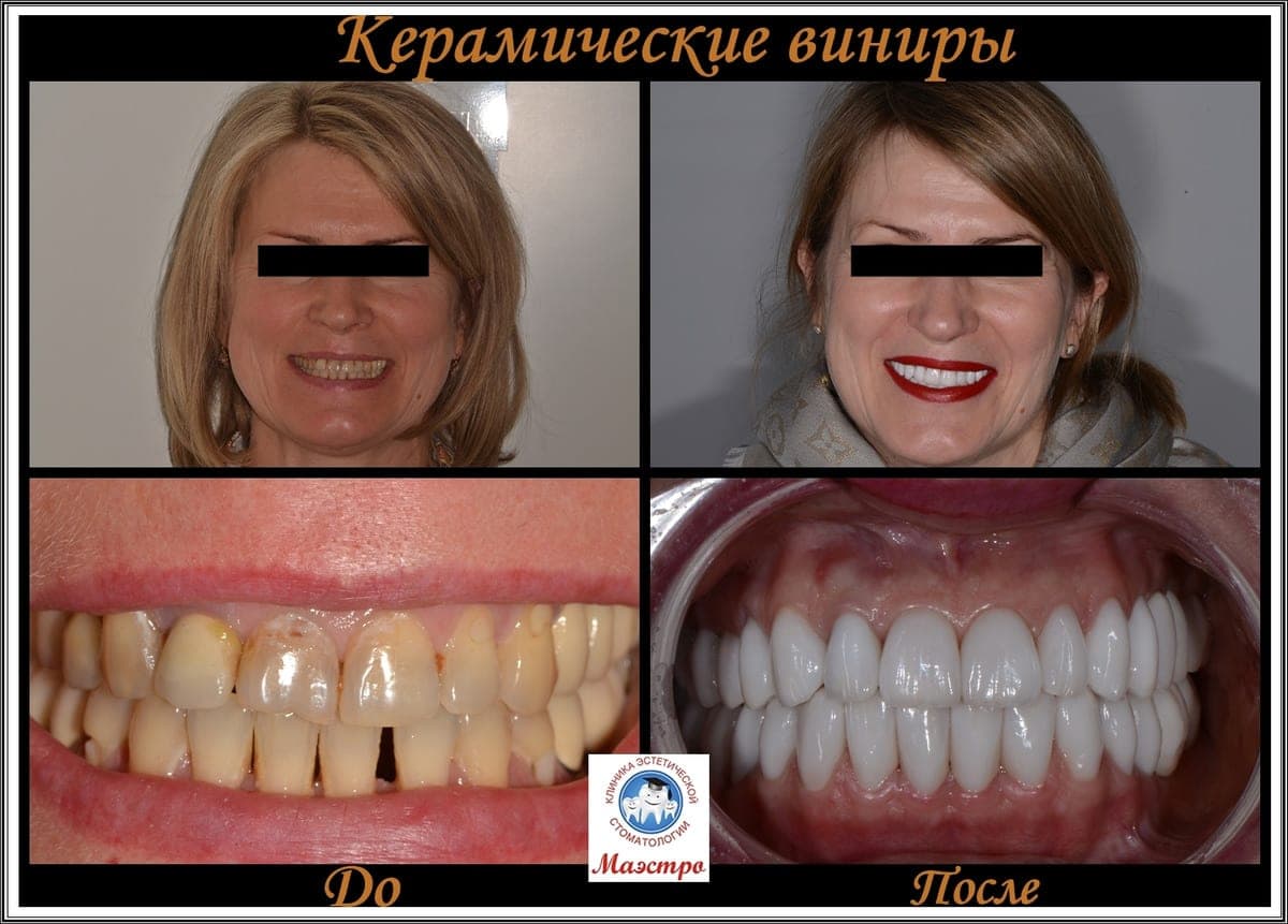 Ортопедия — пациент 16, До и после: портрет и макро