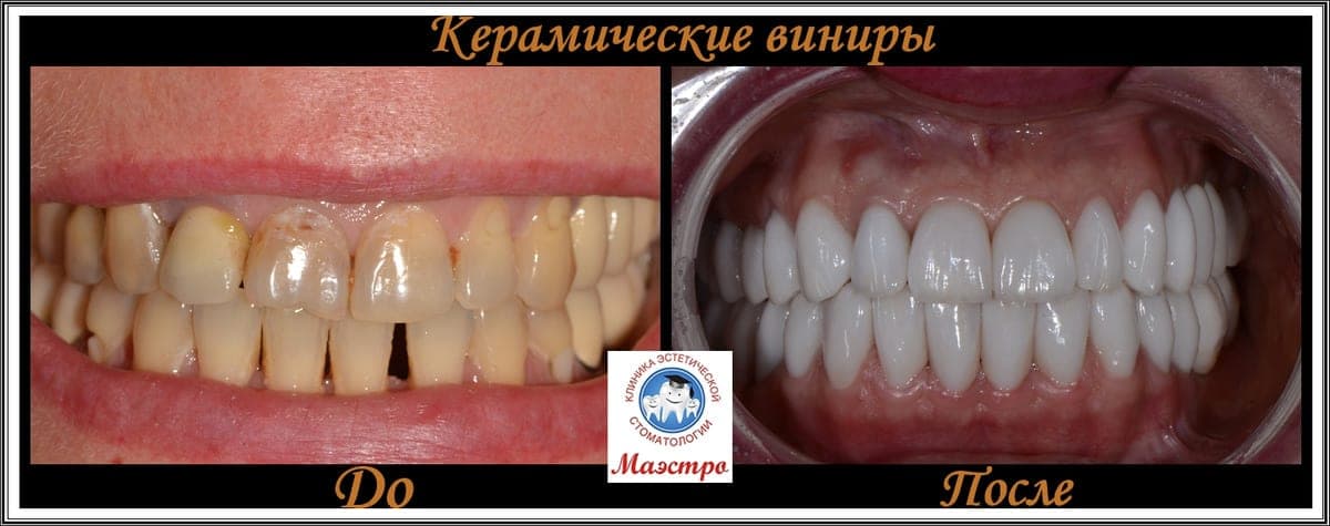Ортопедия — пациент 16, Портрет до лечения