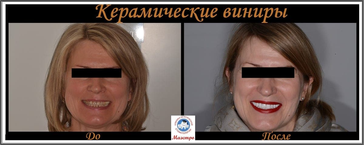 Ортопедия — пациент 16, Портрет после лечения