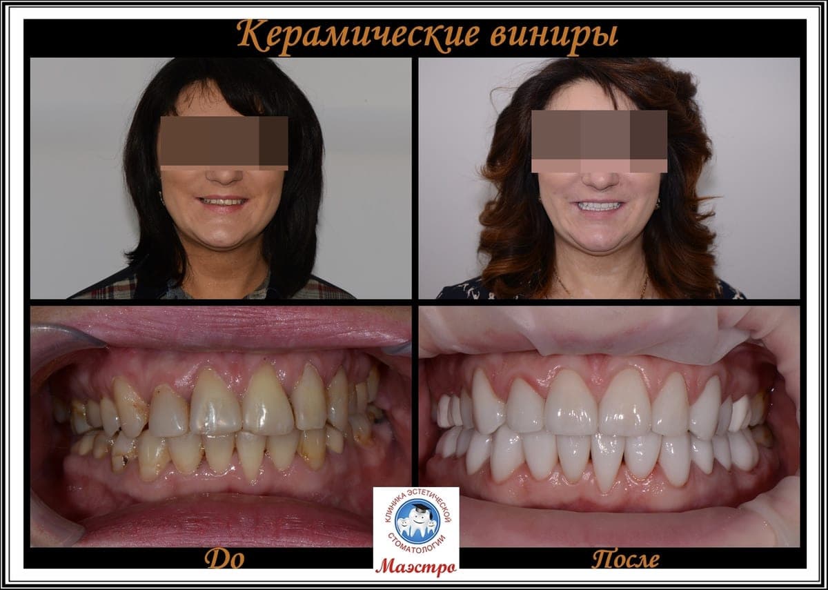 Ортопедия — пациент 17, До и после: портрет и макро