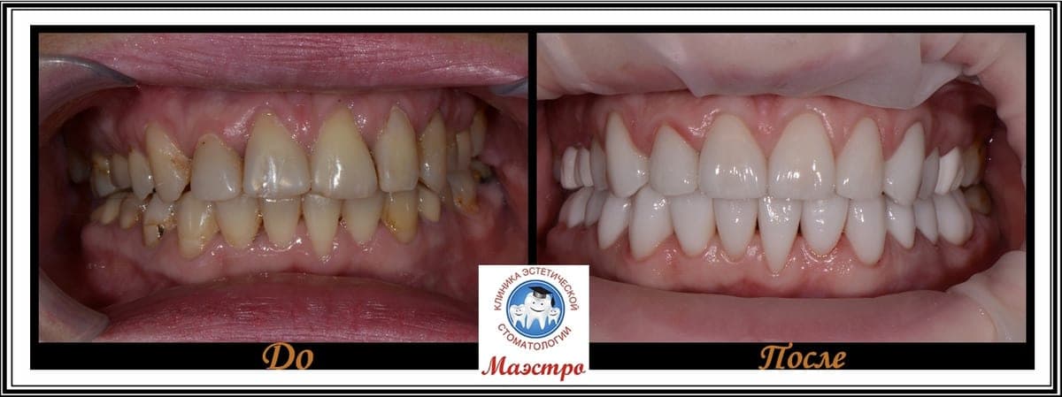 Ортопедия — пациент 17, Крупный план до