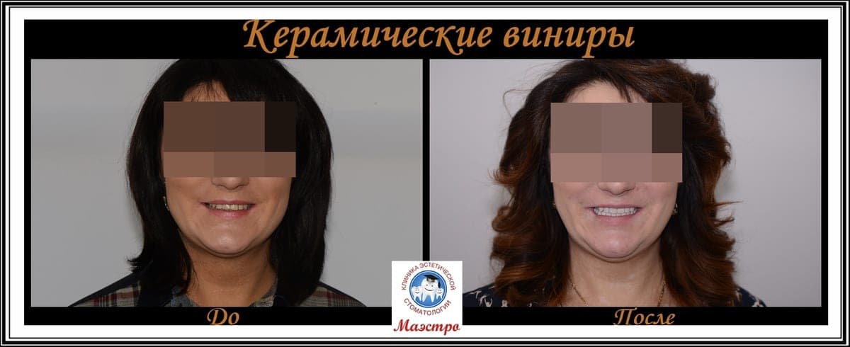 Ортопедия — пациент 17, Крупный план после