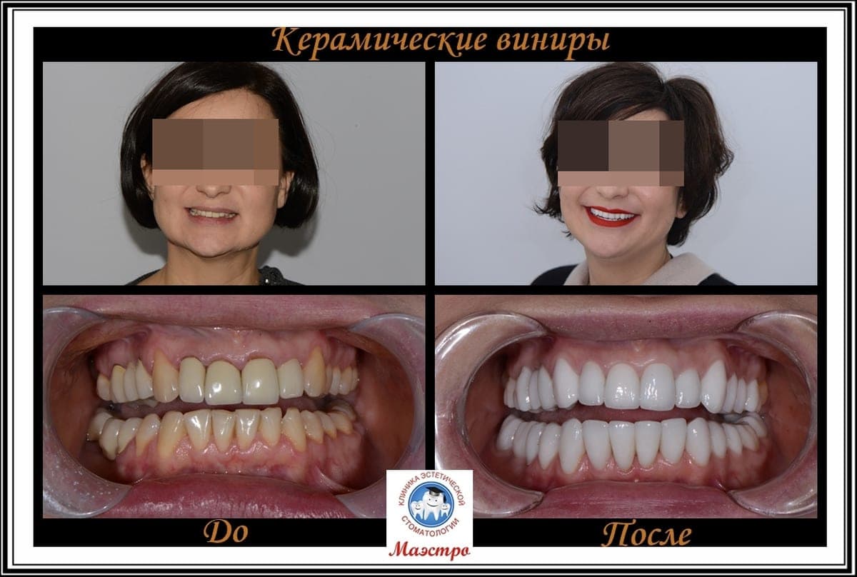 Ортопедия — пациент 18, До и после: портрет и макро