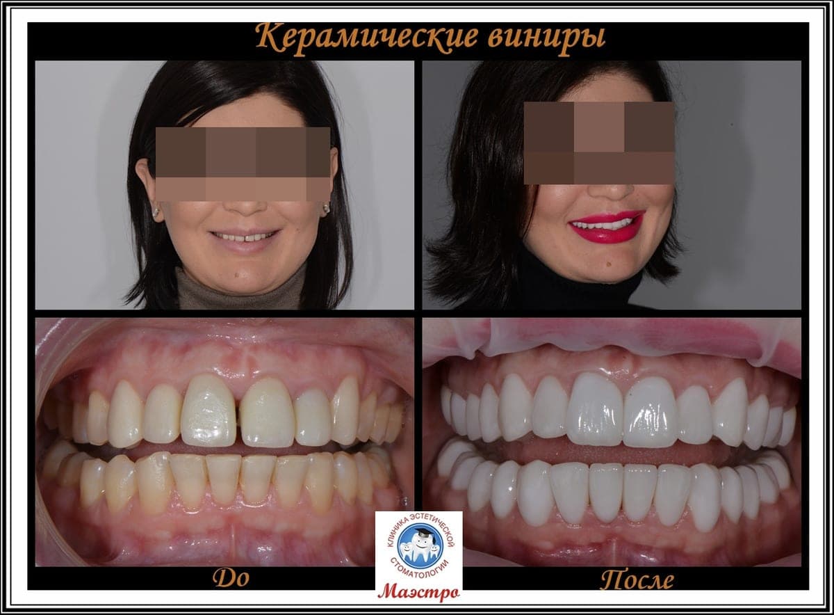 Ортопедия — пациент 19, До и после: портрет и макро