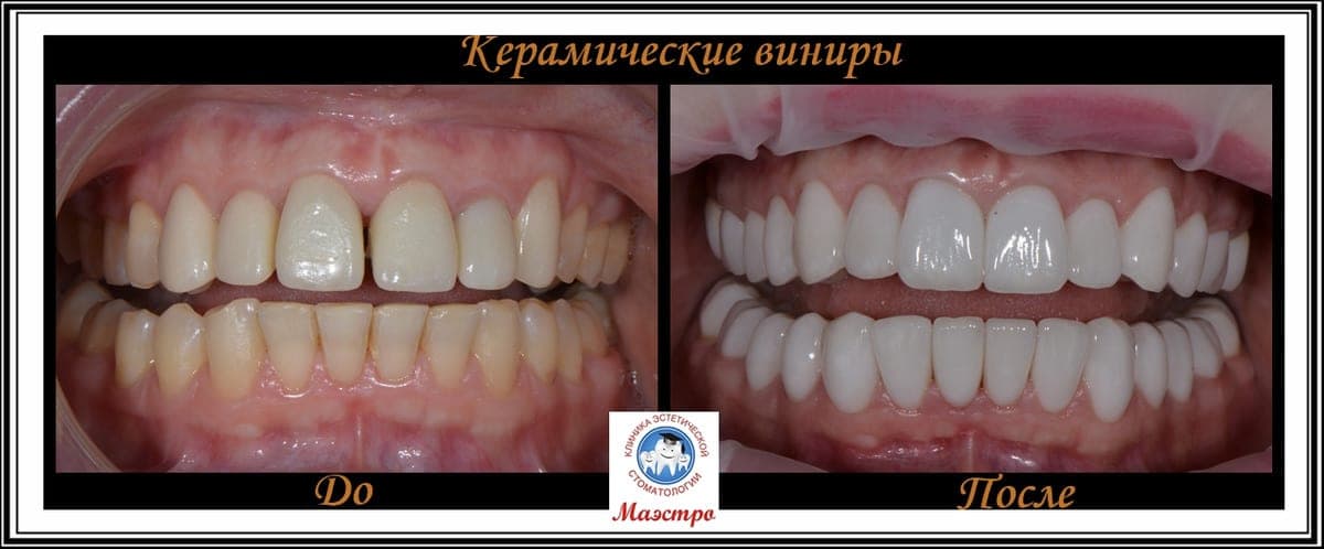 Ортопедия — пациент 19, Портрет до лечения