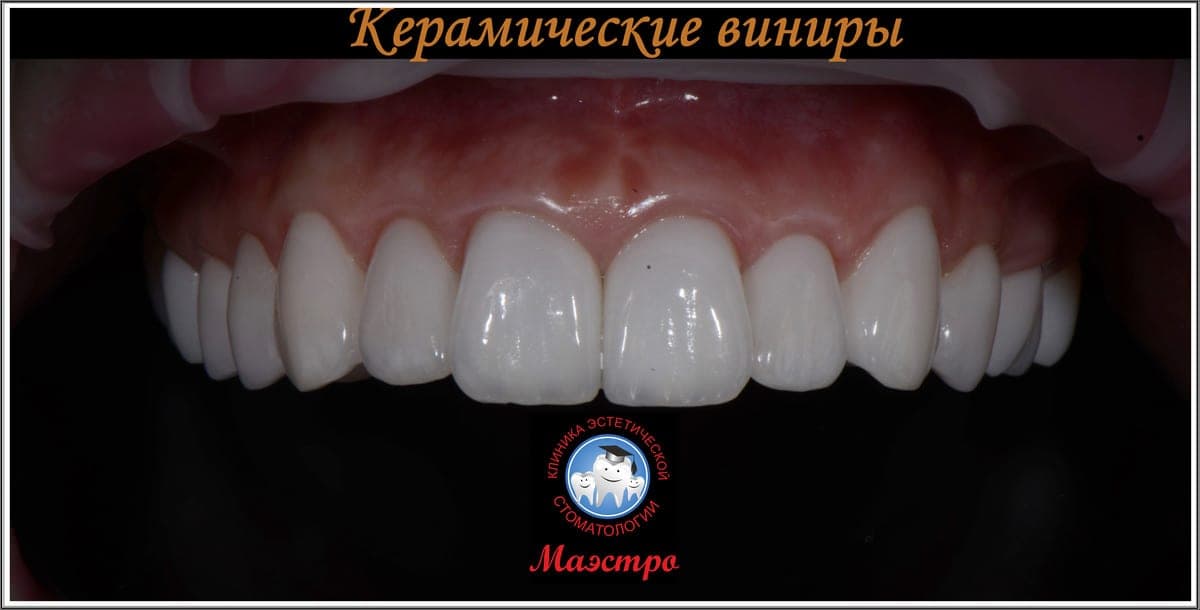 Ортопедия — пациент 19, Крупный план до