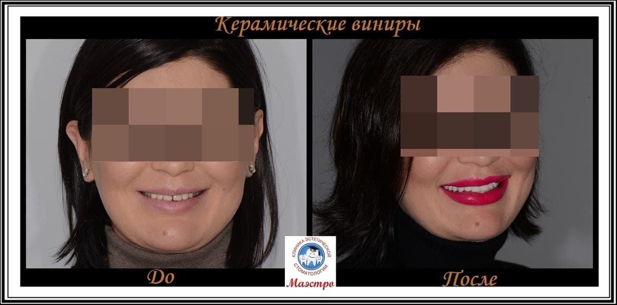 Ортопедия — пациент 19, Крупный план после