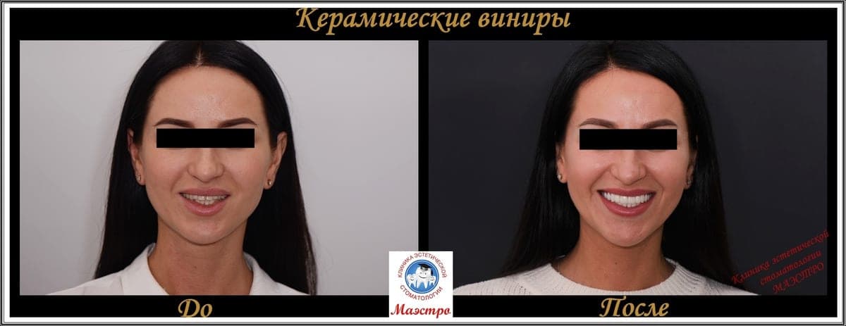 Ортопедия — пациент 2, До и после: портрет