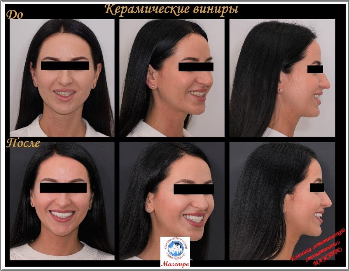 Ортопедия — пациент 2, Детальный результат