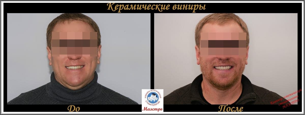 Ортопедия — пациент 3, До и после: портрет