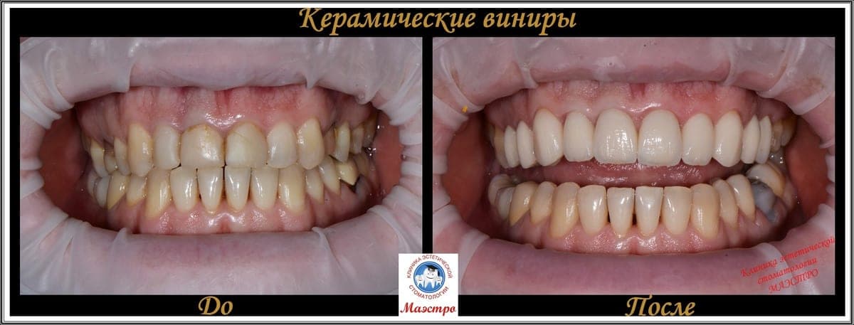 Ортопедия — пациент 3, Крупный план до лечения