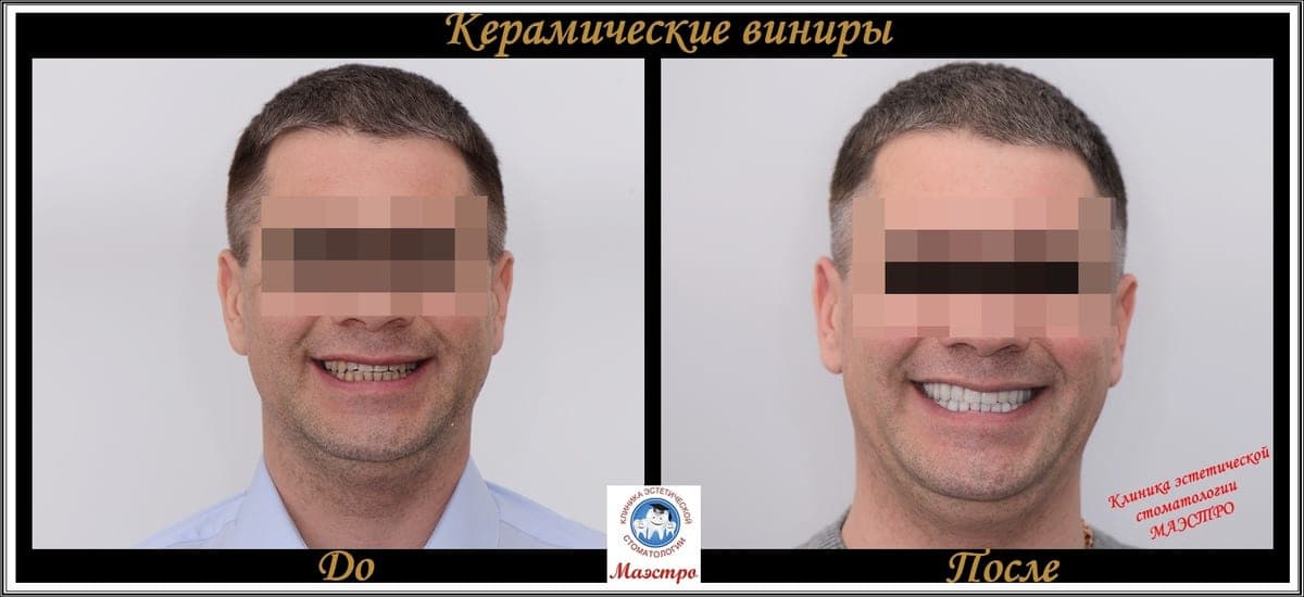 Ортопедия — пациент 4, До и после: портрет