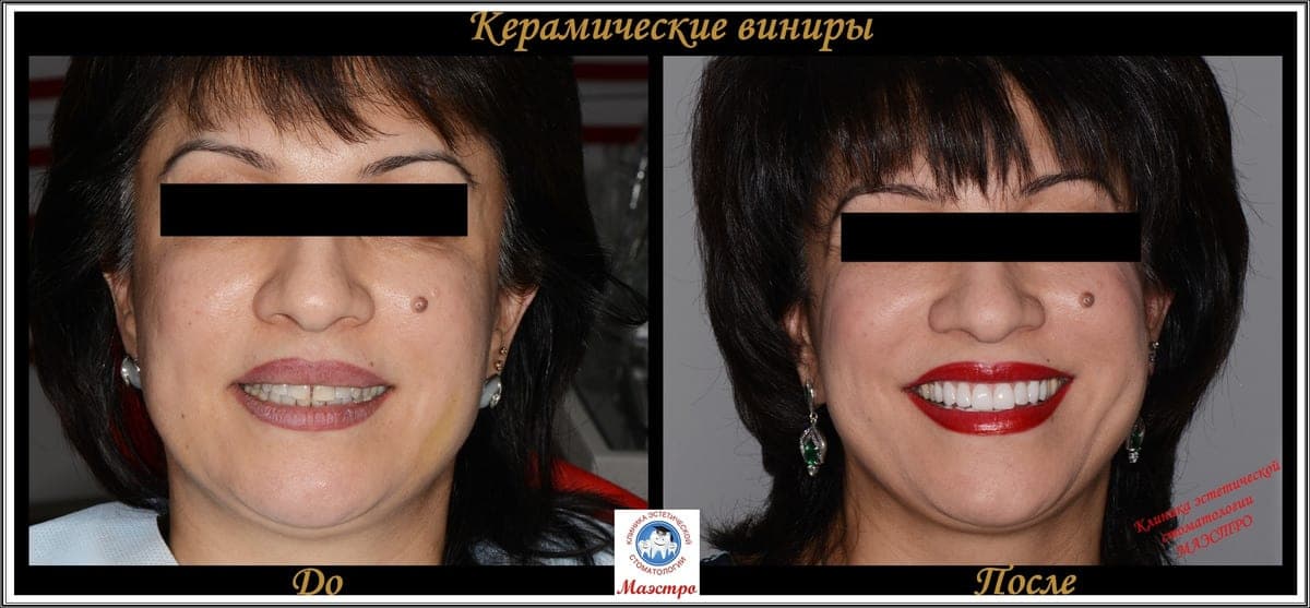 Ортопедия — пациент 5, До и после: портрет