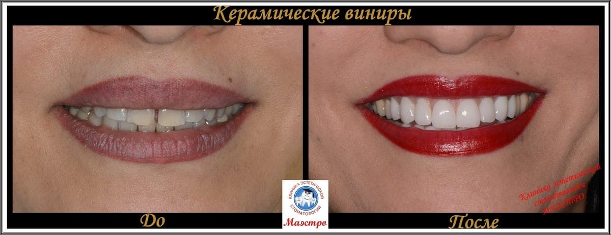 Ортопедия — пациент 5, Крупный план после