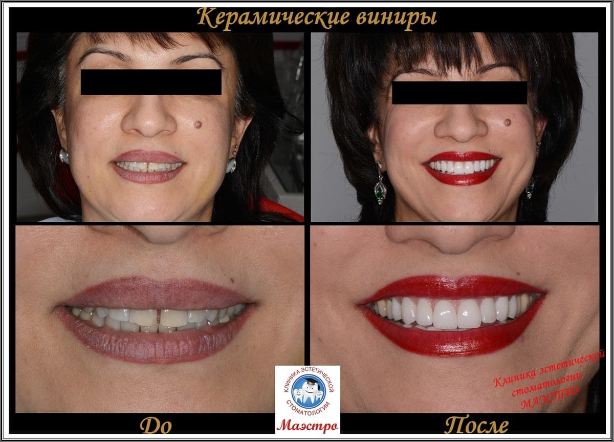 Ортопедия — пациент 5, Финальный результат