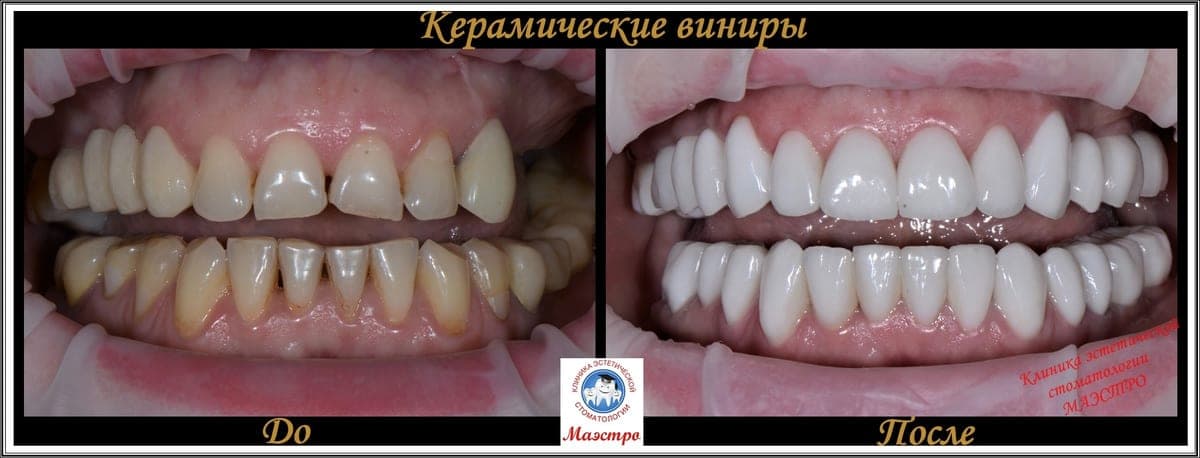 Ортопедия — пациент 6, До и после: крупный план