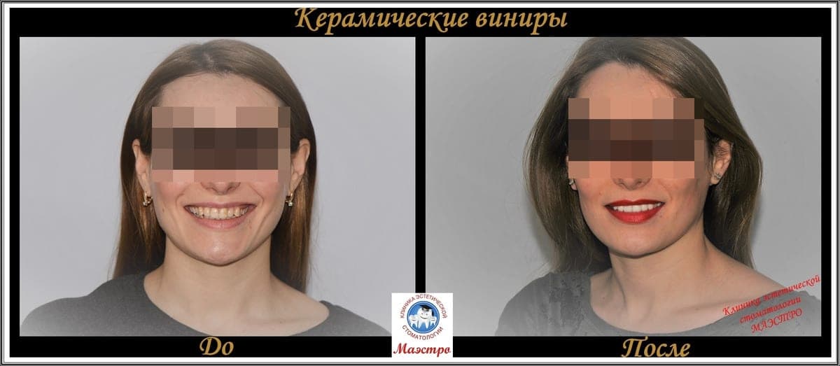Ортопедия — пациент 7, До и после: портрет