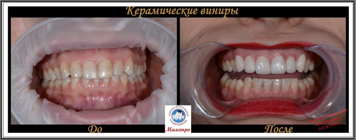 Ортопедия — пациент 7, До лечения