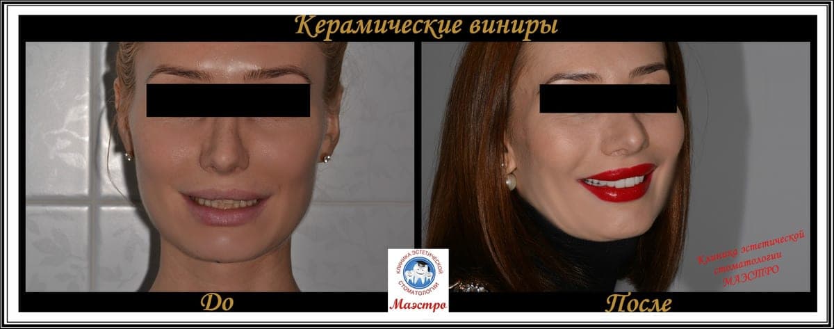 Ортопедия — пациент 8, До и после: портрет