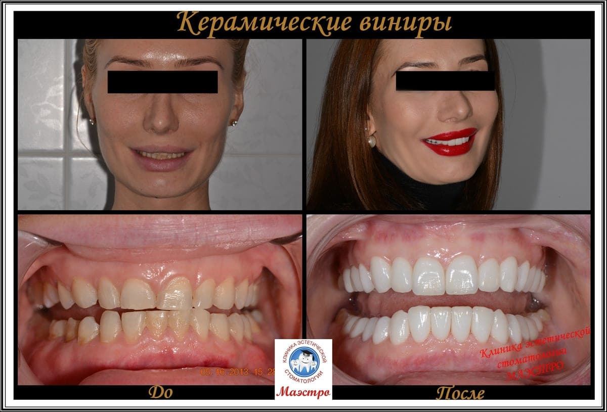 Ортопедия — пациент 8, Крупный план до