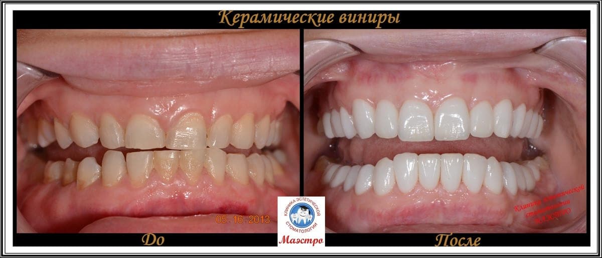 Ортопедия — пациент 8, Крупный план после