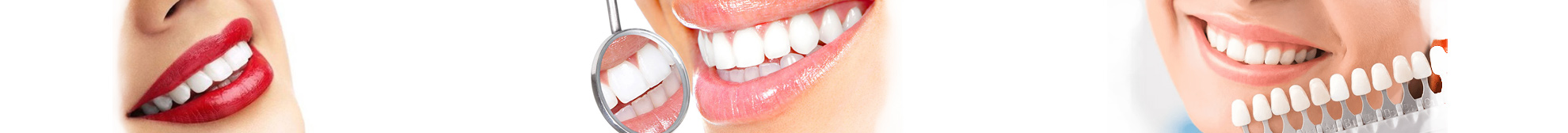 Эстетическая стоматология - Клиника эстетической стоматологии 